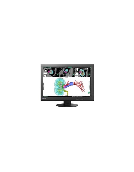 EIZO MONITOR EIZO RADIFORCE MX242W 24 2 3 MPX