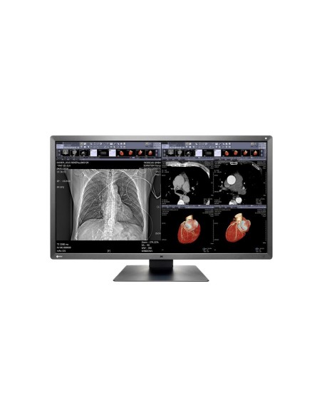 EIZO MONITOR EIZO RADIFORCE MX315W 31,5