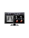 EIZO MONITOR EIZO RADIFORCE MX315W 31,5