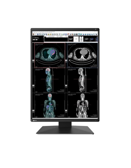 EIZO MONITOR EIZO RADIFORCE RX370 3MP COLORE